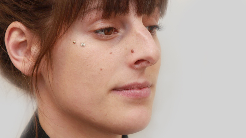 before nose job