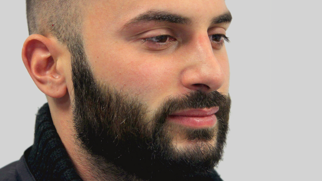 clinique dr karl schwarz montreal nose job after