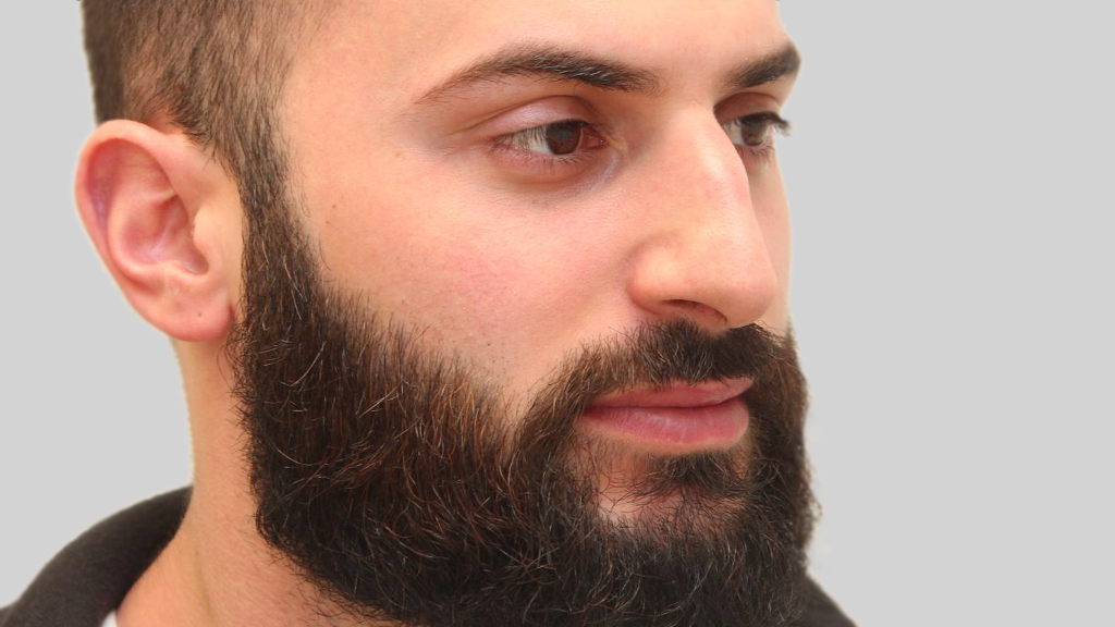 clinique dr karl schwarz montreal nose job before