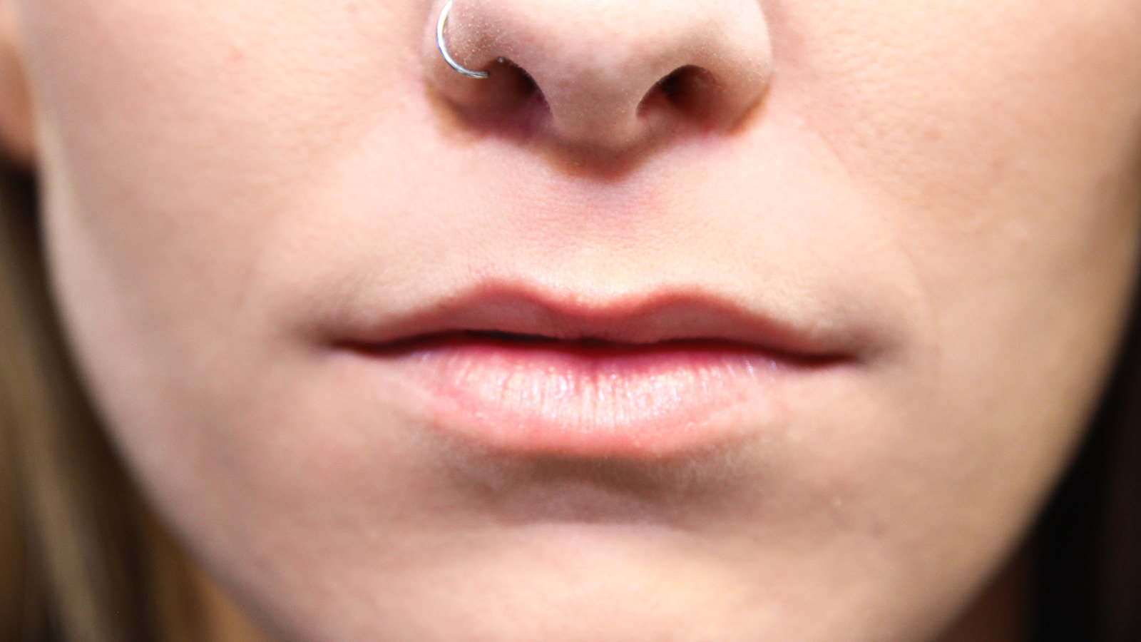 nose job montreal