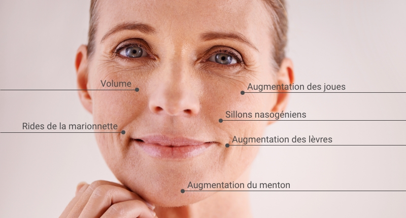 CliniqueK-Christina-Agents-Comblements